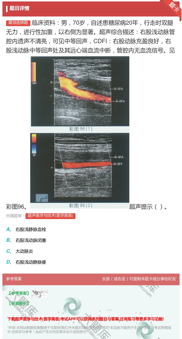 答案:临床资料男70岁自述患糖尿病20年行走时双腿无力进行性加重以...