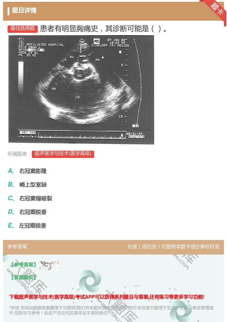 答案:患者有明显胸痛史其诊断可能是...