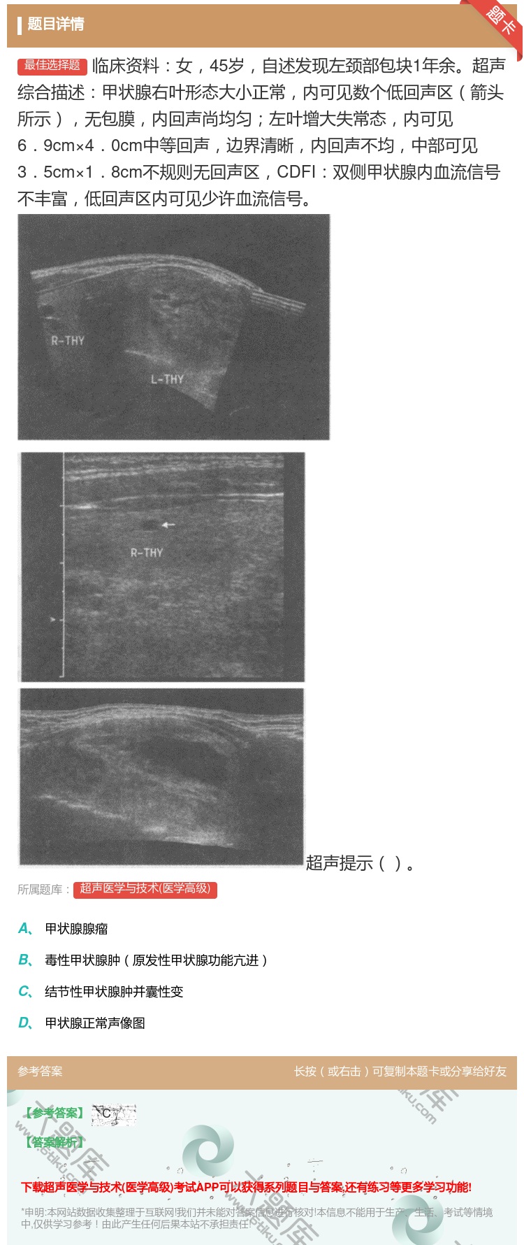 答案:临床资料女45岁自述发现左颈部包块1年余超声综合描述甲状腺右...