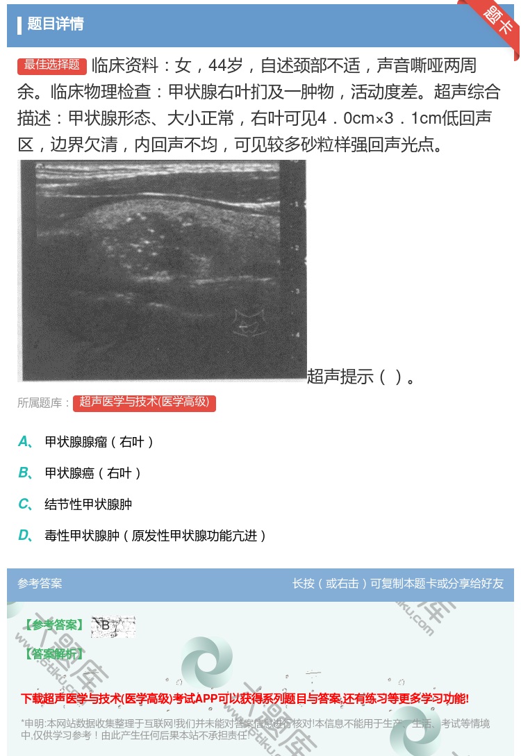 答案:临床资料女44岁自述颈部不适声音嘶哑两周余临床物理检查甲状腺...