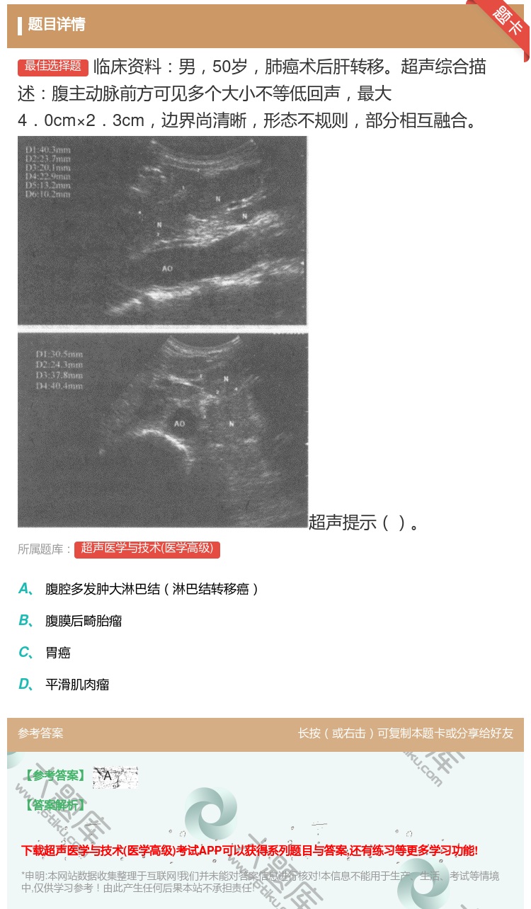答案:临床资料男50岁肺癌术后肝转移超声综合描述腹主动脉前方可见多...
