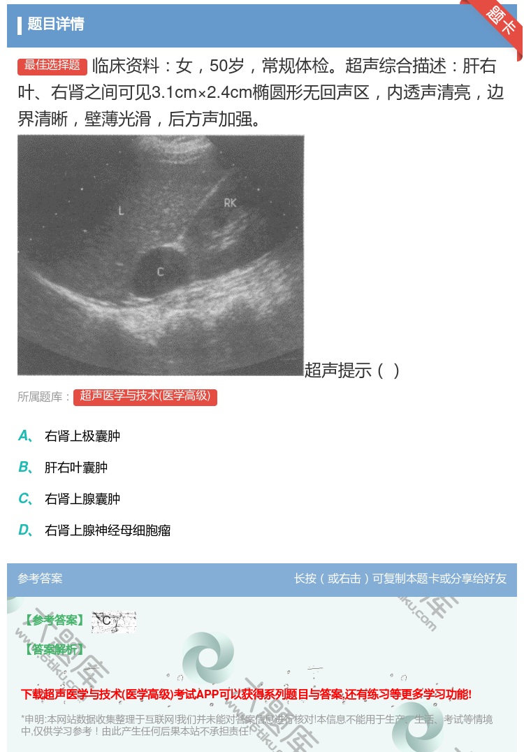 答案:临床资料女50岁常规体检超声综合描述肝右叶右肾之间可见3.1...