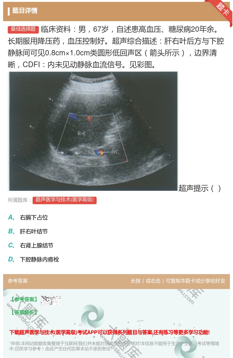 答案:临床资料男67岁自述患高血压糖尿病20年余长期服用降压药血压...