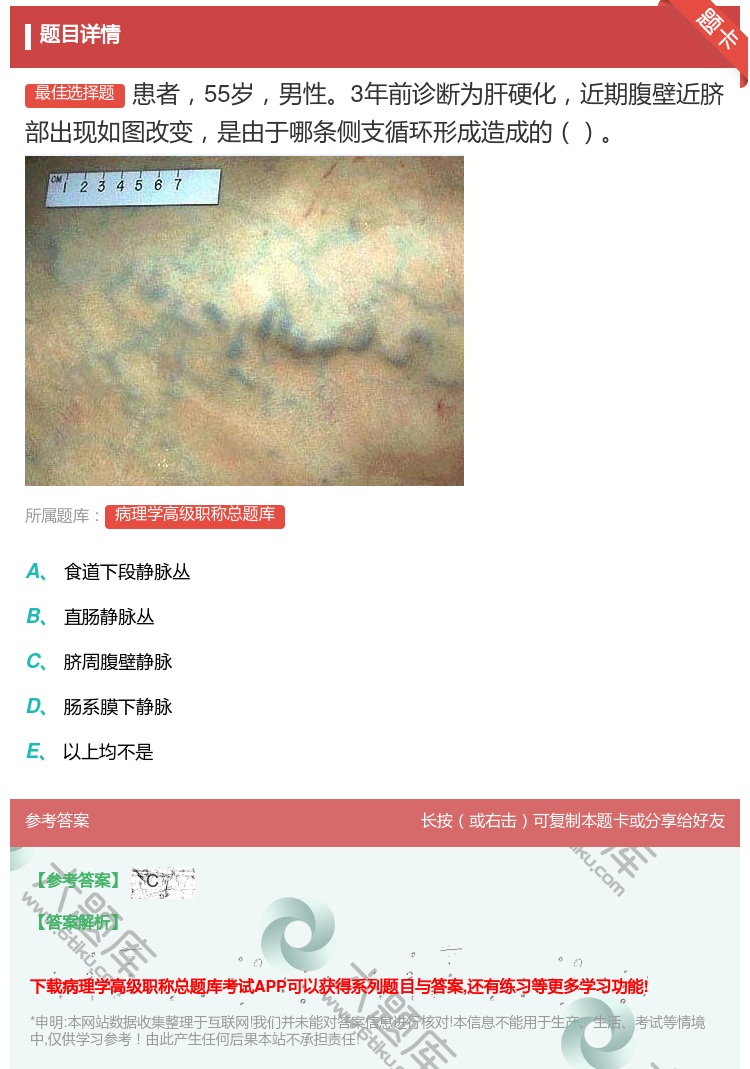 答案:患者55岁男性3年前诊断为肝硬化近期腹壁近脐部出现如图改变是...